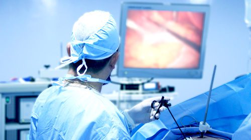 Cirugía Bariátrica