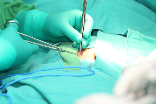 Hernia